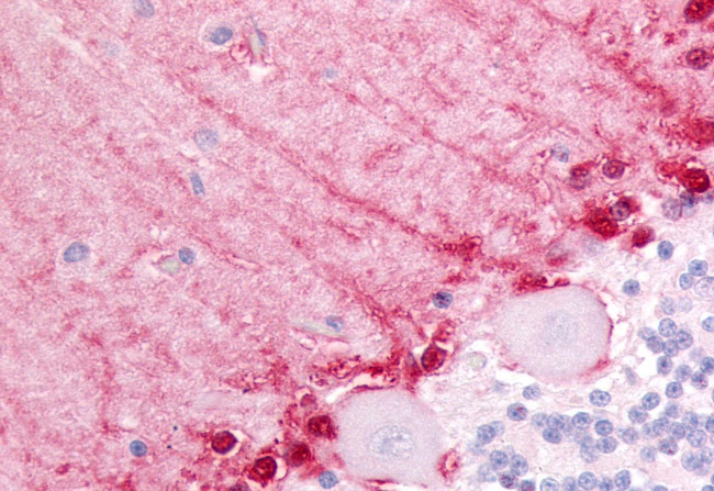 BAI3 Antibody in Immunohistochemistry (Paraffin) (IHC (P))