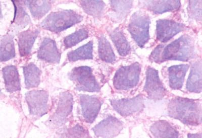 BDKRB2 Antibody in Immunocytochemistry (ICC/IF)