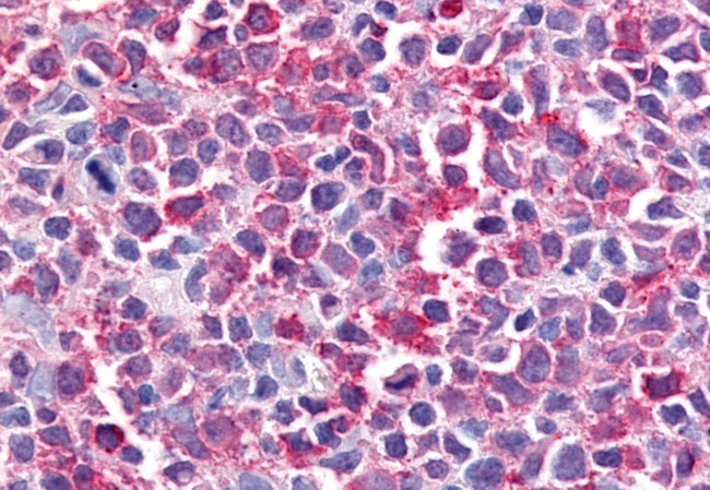 Bestrophin 2 Antibody in Immunohistochemistry (Paraffin) (IHC (P))