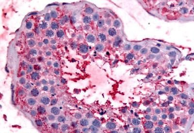 Bestrophin 2 Antibody in Immunohistochemistry (Paraffin) (IHC (P))