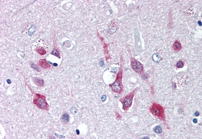 CaV1.2 Antibody in Immunohistochemistry (Paraffin) (IHC (P))