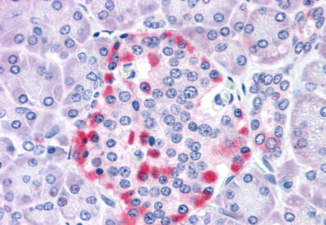 CADM4 Antibody in Immunohistochemistry (Paraffin) (IHC (P))