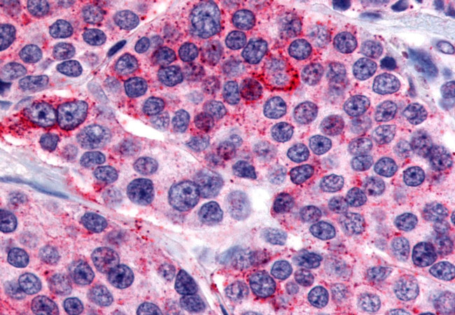 Calcitonin Receptor Antibody in Immunohistochemistry (Paraffin) (IHC (P))