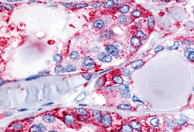 Calcitonin Receptor Antibody in Immunohistochemistry (Paraffin) (IHC (P))
