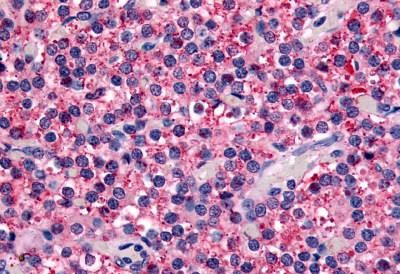 Calcium Sensing Receptor Antibody in Immunohistochemistry (Paraffin) (IHC (P))