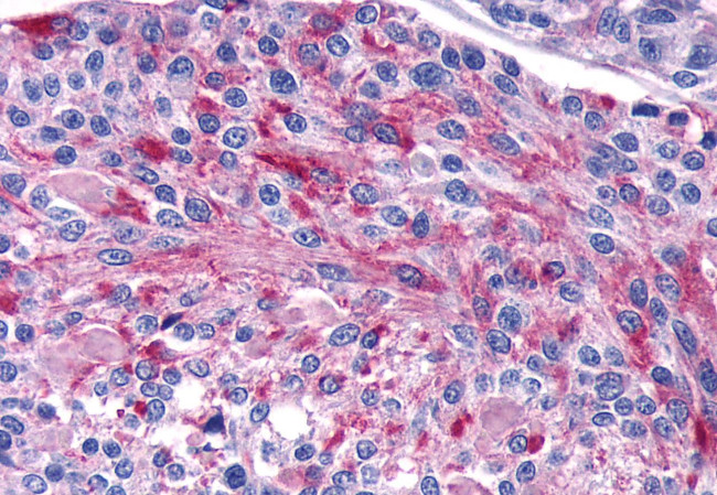 Calcium Sensing Receptor Antibody in Immunohistochemistry (Paraffin) (IHC (P))