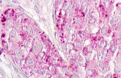 CCRD6 Antibody in Immunohistochemistry (Paraffin) (IHC (P))