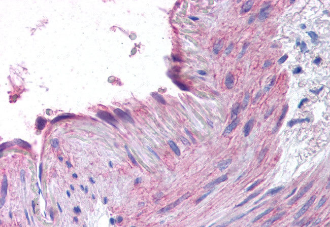 CCR1 Antibody in Immunohistochemistry (Paraffin) (IHC (P))