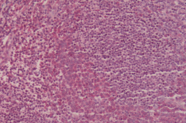 CCR2 Antibody in Immunohistochemistry (Paraffin) (IHC (P))