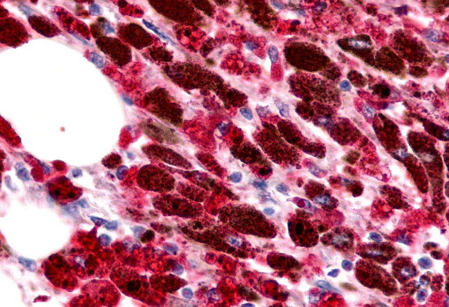 CCR11 Antibody in Immunohistochemistry (Paraffin) (IHC (P))