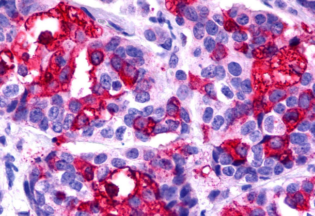 CCR11 Antibody in Immunohistochemistry (Paraffin) (IHC (P))