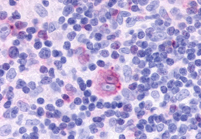 CCRL2 Antibody in Immunohistochemistry (Paraffin) (IHC (P))