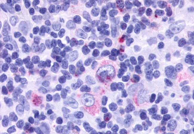 CCRL2 Antibody in Immunohistochemistry (Paraffin) (IHC (P))