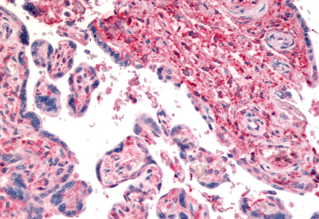 CD26 Antibody in Immunohistochemistry (Paraffin) (IHC (P))