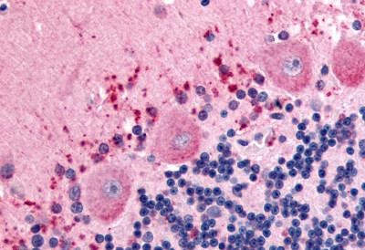CELSR3 Antibody in Immunohistochemistry (Paraffin) (IHC (P))