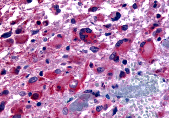 CHRM2 Antibody in Immunohistochemistry (Paraffin) (IHC (P))