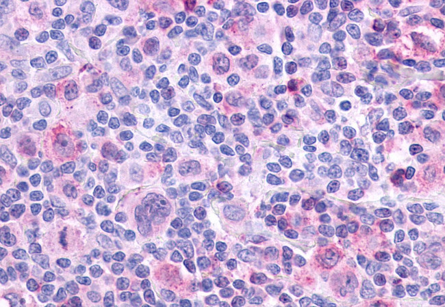 CHRM4 Antibody in Immunohistochemistry (Paraffin) (IHC (P))