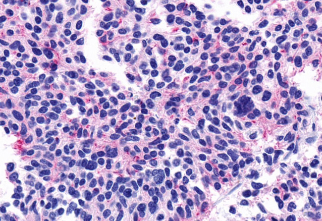 CHRM5 Antibody in Immunohistochemistry (Paraffin) (IHC (P))