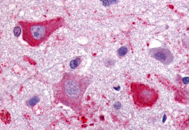 CMKLR1 Antibody in Immunohistochemistry (Paraffin) (IHC (P))