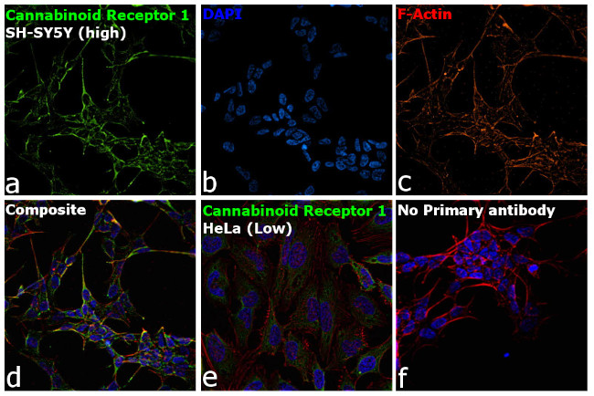 Cannabinoid Receptor 1 Antibody in Immunocytochemistry (ICC/IF)