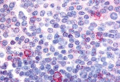 CNR2 Antibody in Immunohistochemistry (Paraffin) (IHC (P))
