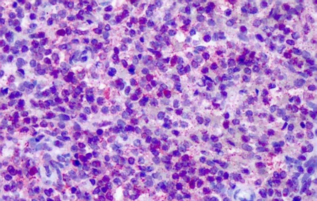 CNR2 Antibody in Immunohistochemistry (Paraffin) (IHC (P))