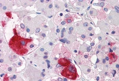 CRHR2 Antibody in Immunohistochemistry (Paraffin) (IHC (P))
