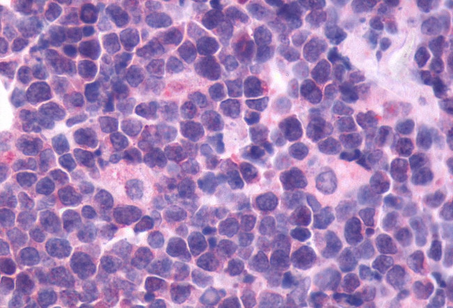 CXCR5 Antibody in Immunohistochemistry (Paraffin) (IHC (P))