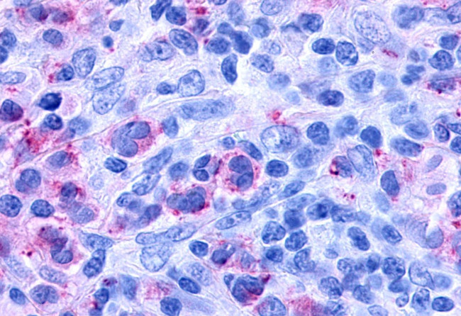 CYSLTR1 Antibody in Immunohistochemistry (Paraffin) (IHC (P))