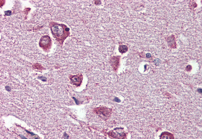 DPP10 Antibody in Immunohistochemistry (Paraffin) (IHC (P))