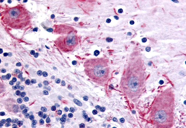 DPP10 Antibody in Immunohistochemistry (Paraffin) (IHC (P))