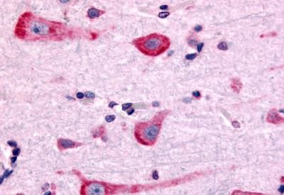 DRD2 Antibody in Immunohistochemistry (Paraffin) (IHC (P))