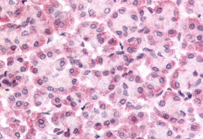 DUSP22 Antibody in Immunohistochemistry (Paraffin) (IHC (P))