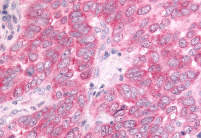 DUSP22 Antibody in Immunohistochemistry (Paraffin) (IHC (P))