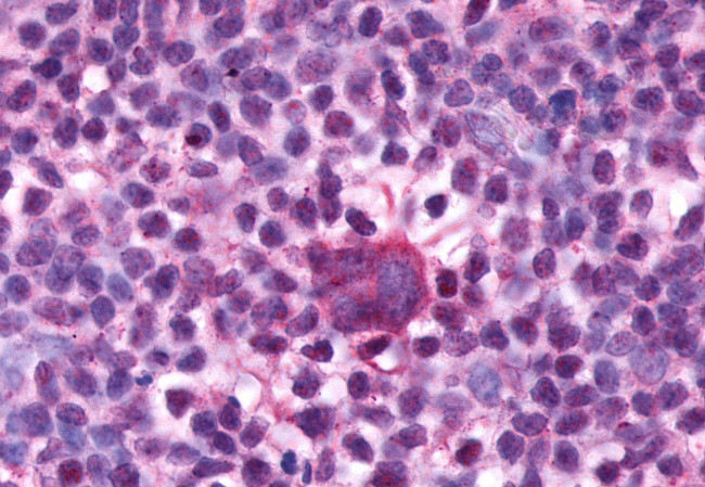 F4/80 Antibody in Immunohistochemistry (Paraffin) (IHC (P))