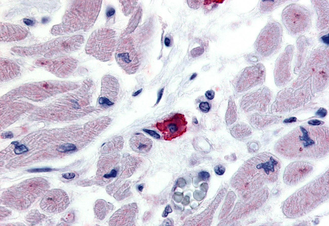 EMR3 Antibody in Immunohistochemistry (Paraffin) (IHC (P))