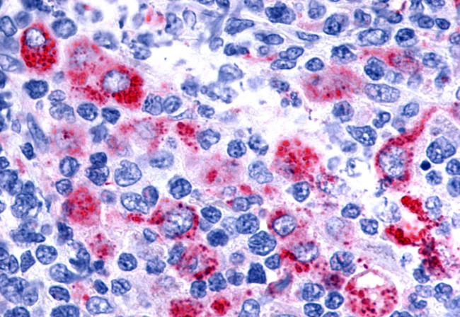 EMR3 Antibody in Immunohistochemistry (Paraffin) (IHC (P))