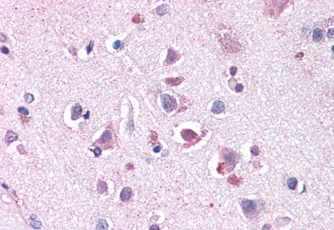 ENT1 Antibody in Immunohistochemistry (Paraffin) (IHC (P))