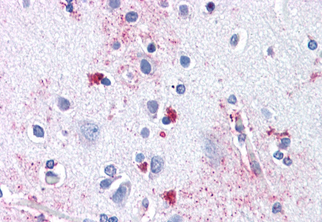 ENT1 Antibody in Immunohistochemistry (Paraffin) (IHC (P))