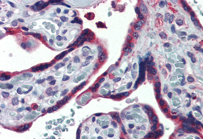 ERP44 Antibody in Immunohistochemistry (Paraffin) (IHC (P))