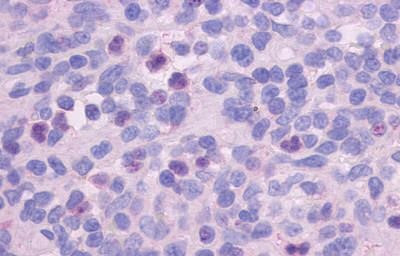 FPR1 Antibody in Immunohistochemistry (Paraffin) (IHC (P))