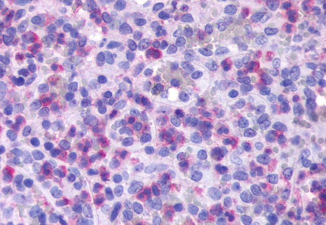 FPR1 Antibody in Immunohistochemistry (Paraffin) (IHC (P))