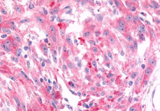 FZD6 Antibody in Immunohistochemistry (Paraffin) (IHC (P))