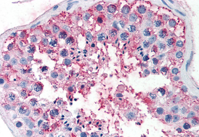 FSHR Antibody in Immunohistochemistry (Paraffin) (IHC (P))