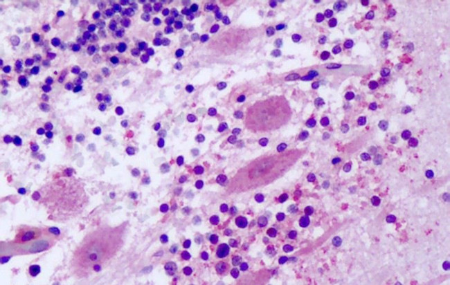 FZD8 Antibody in Immunohistochemistry (Paraffin) (IHC (P))
