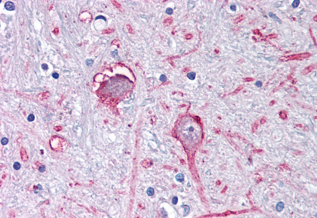 GABRA3 Antibody in Immunohistochemistry (Paraffin) (IHC (P))