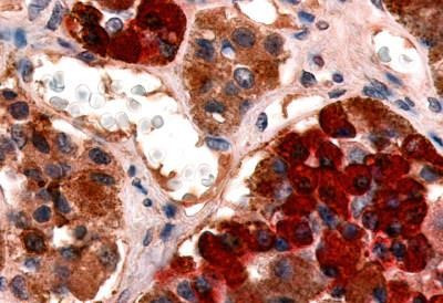 GHRHR Antibody in Immunohistochemistry (Paraffin) (IHC (P))