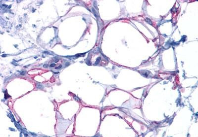 Glucagon Receptor Antibody in Immunohistochemistry (Paraffin) (IHC (P))