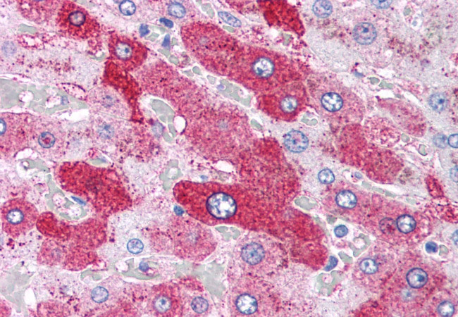 Glucagon Receptor Antibody in Immunohistochemistry (Paraffin) (IHC (P))
