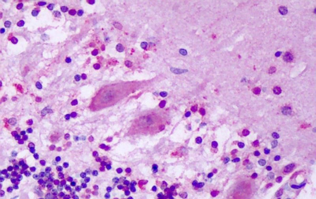 GPR1 Antibody in Immunohistochemistry (Paraffin) (IHC (P))